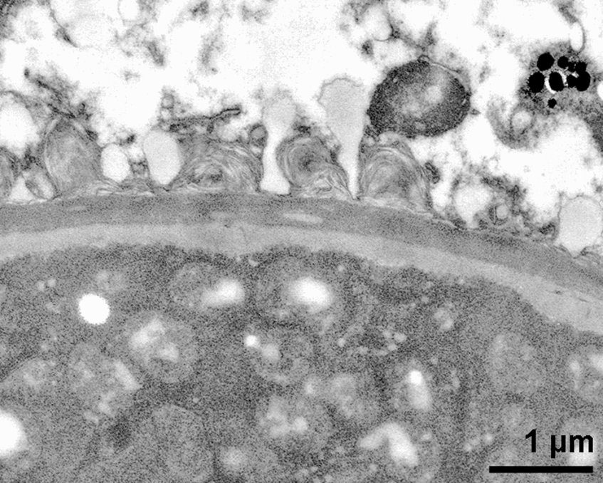 TEM-Aufnahme von Anubias afzelii