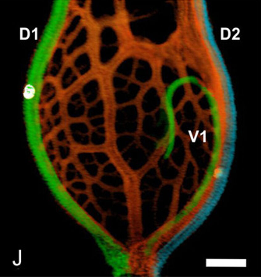 Ovary with ovule (HRXCT, 2D reconstructions in longitudinal sections) of the pistillate flower of Celtis species, C. occidentalis (© Leme et al. 2021, Fig. 8J)